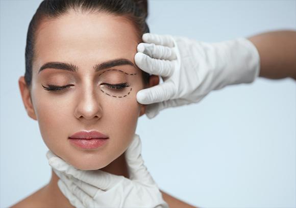 Rhinoplasty Manchester, Liverpool & Leeds. Blepharoplasty. Woman with lines drawn on eye.